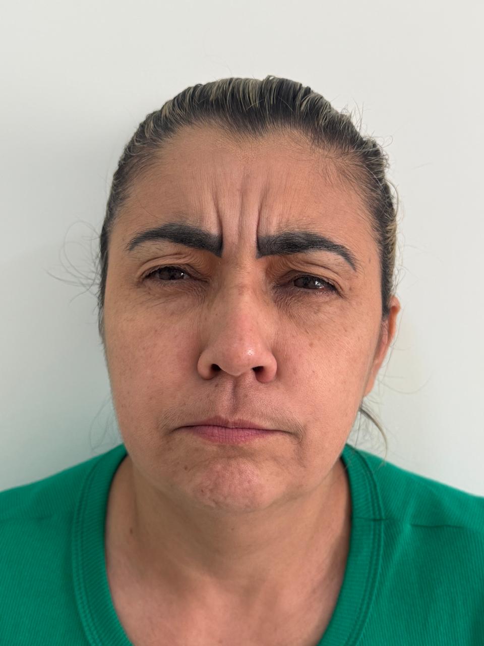 Antes da harmonização