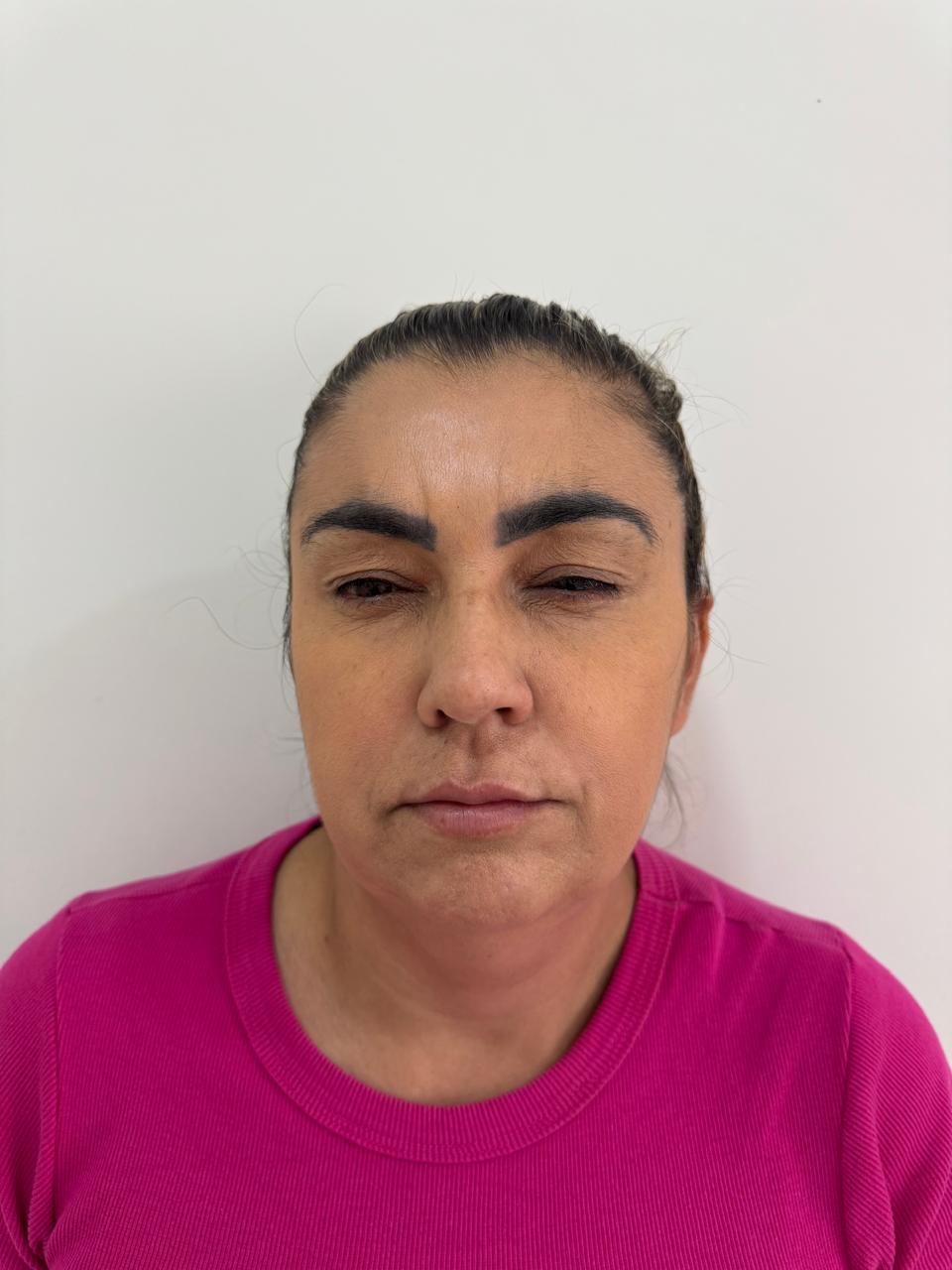 Depois da harmonização