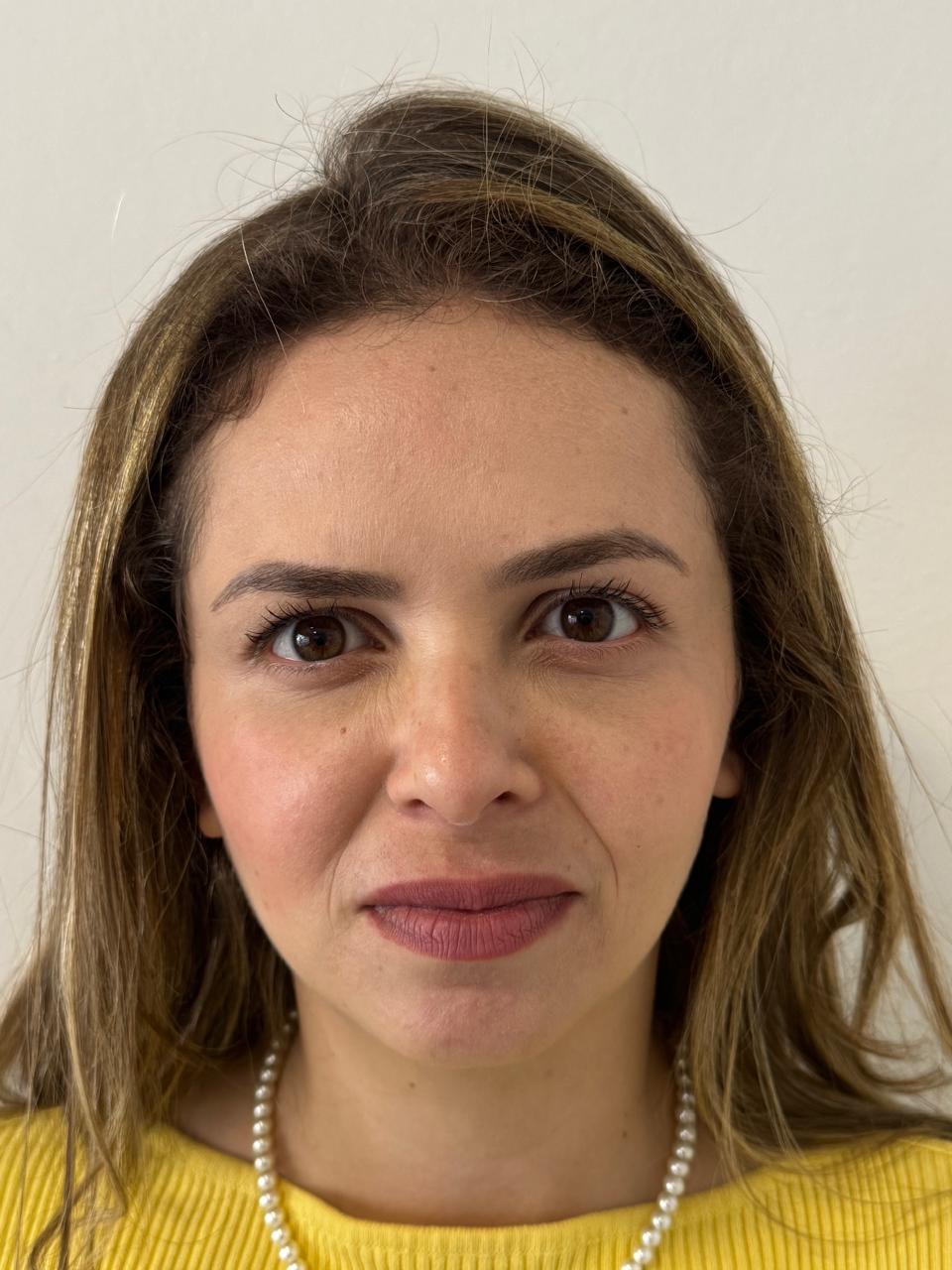 Depois da harmonização